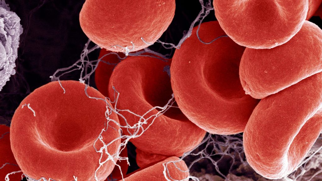 What Is The Truth About Blood Clots?