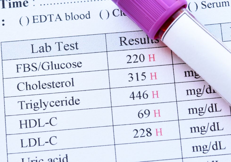 Bloodwork test results